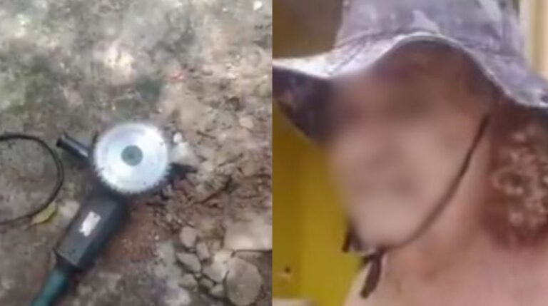 Vídeo chocante: homem tem barriga cortada por serra elétrica
